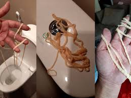 Referencia: Alta carga parasitaria